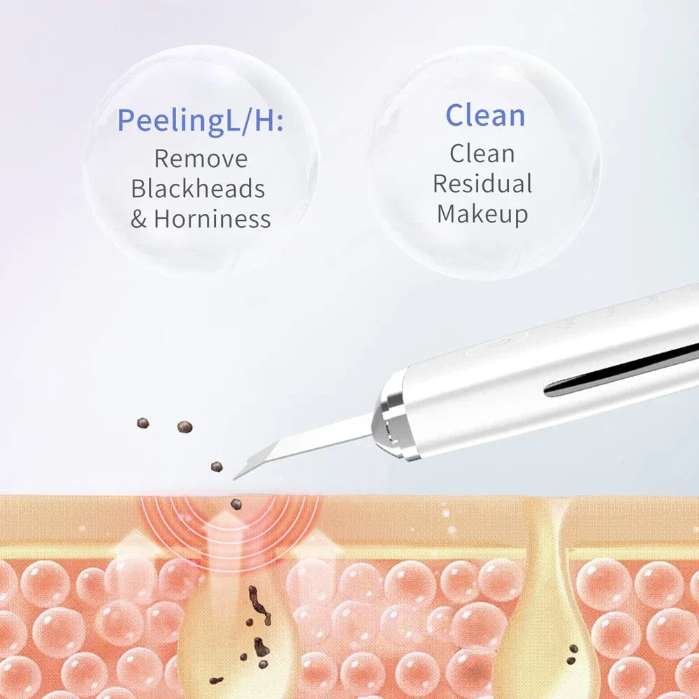 Electric Facial Skin Scrubber