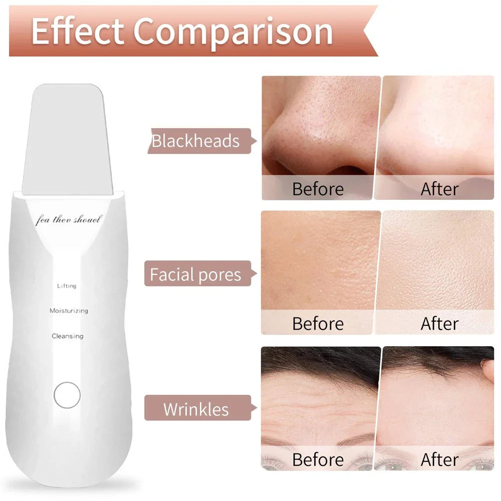 Electric Facial Skin Scrubber