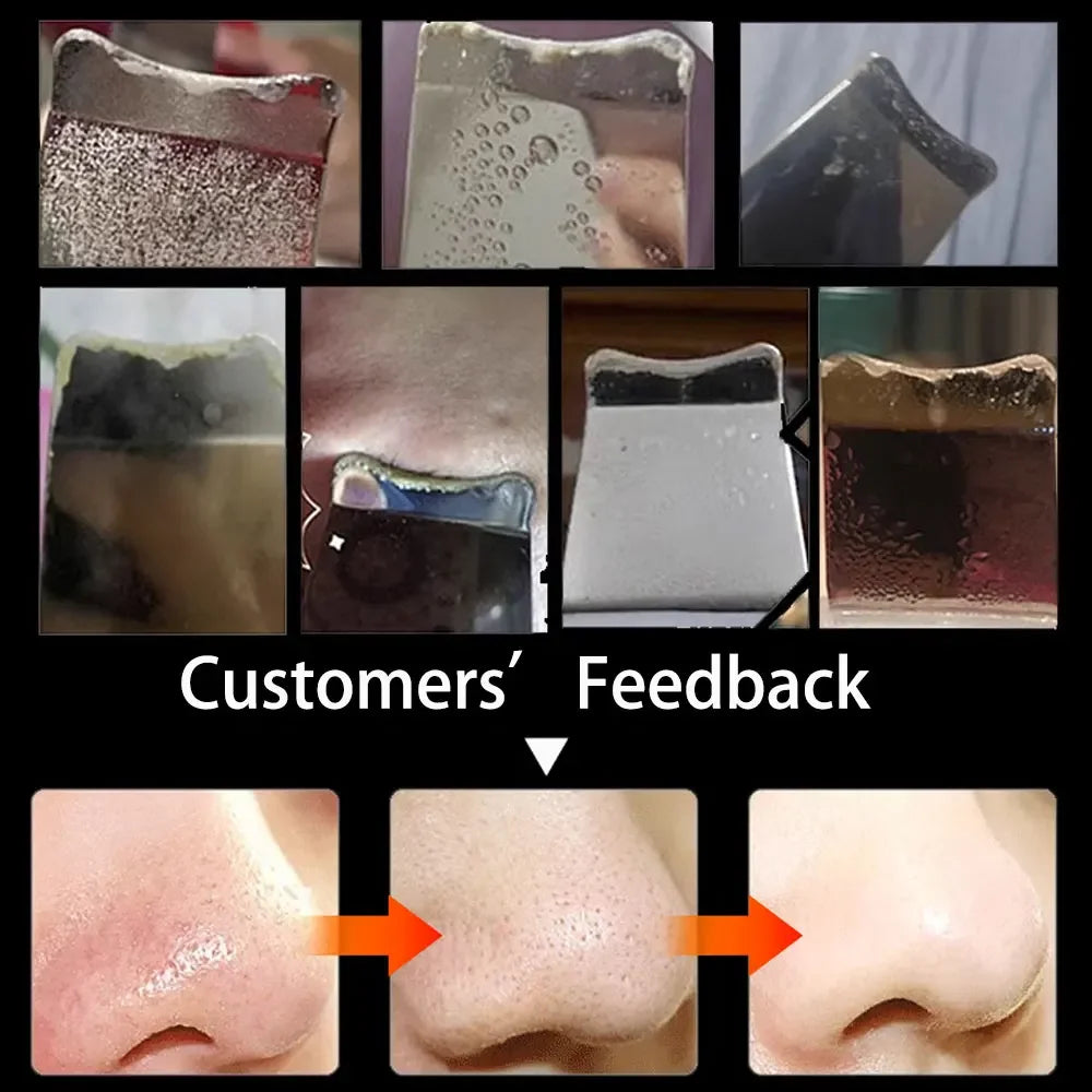 Electric Facial Skin Scrubber
